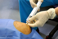 Kemik Sıvısı Özellikleri ve Faydaları Nelerdir?